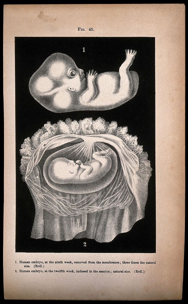 Human embryo, two figures: above, the foetus at nine weeks, below, the foetus at twelve weeks, shown enclosed in the amnion.…