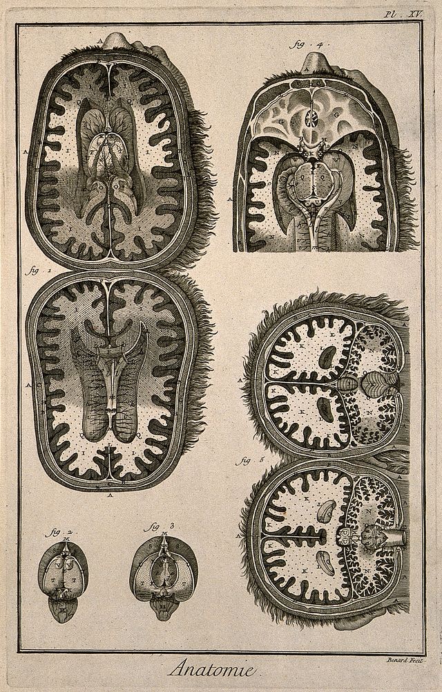 Coronal and sagittal sections of the brain, after Tarin. Engraving by Benard, late 18th century.
