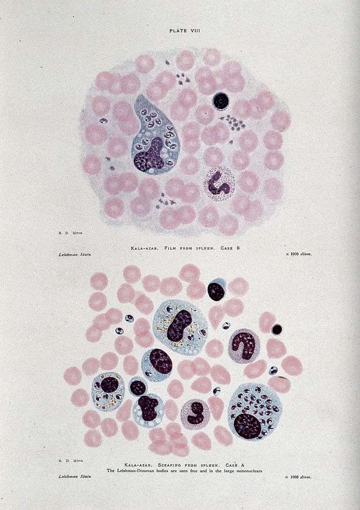 Protozoan parasites at 1000X magnification. Coloured process print after R. D. Muir.