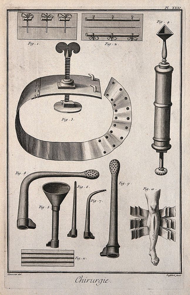 Surgery: surgical instruments, including a tourniquet. Engraving with etching by A.J. Defehrt after L.-J. Goussier.