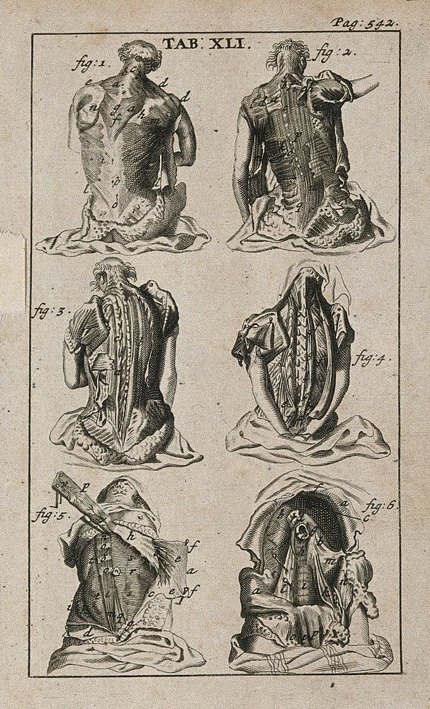 Muscles of the back and abdomen. Engraving, 1686, after Gérard de Lairesse, 1685.