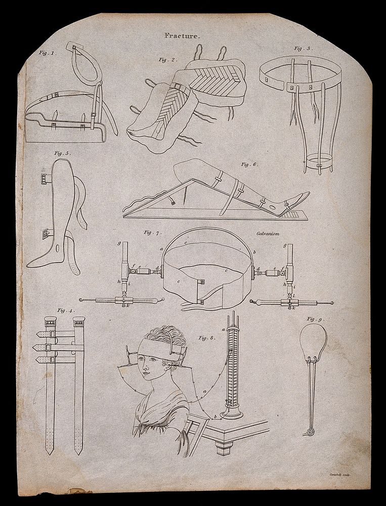 Surgical implements for the treatment of fractures. Engraving by Campbell.