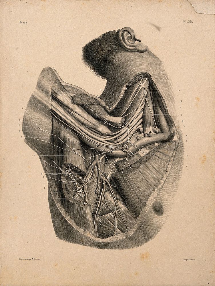 Dissection of the neck and shoulder, showing the brachial plexus. Lithograph by N.H Jacob, 1831/1854.