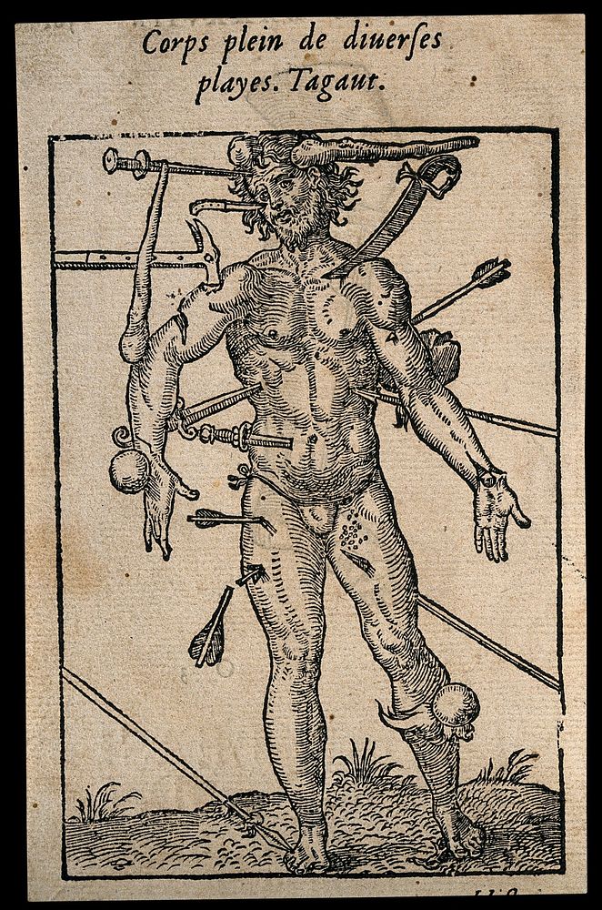Wound man showing all the weapons and points of injury. Woodcut.
