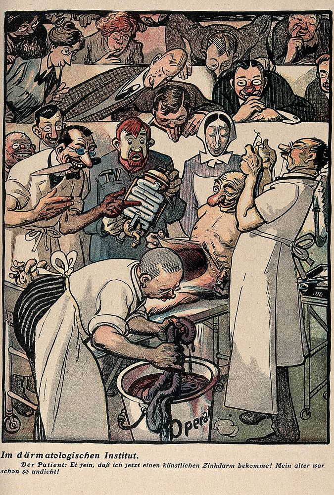 A surgeon is about to implant mechanical intestines in a patient in an operating theatre attended by a crowd of onlookers.…