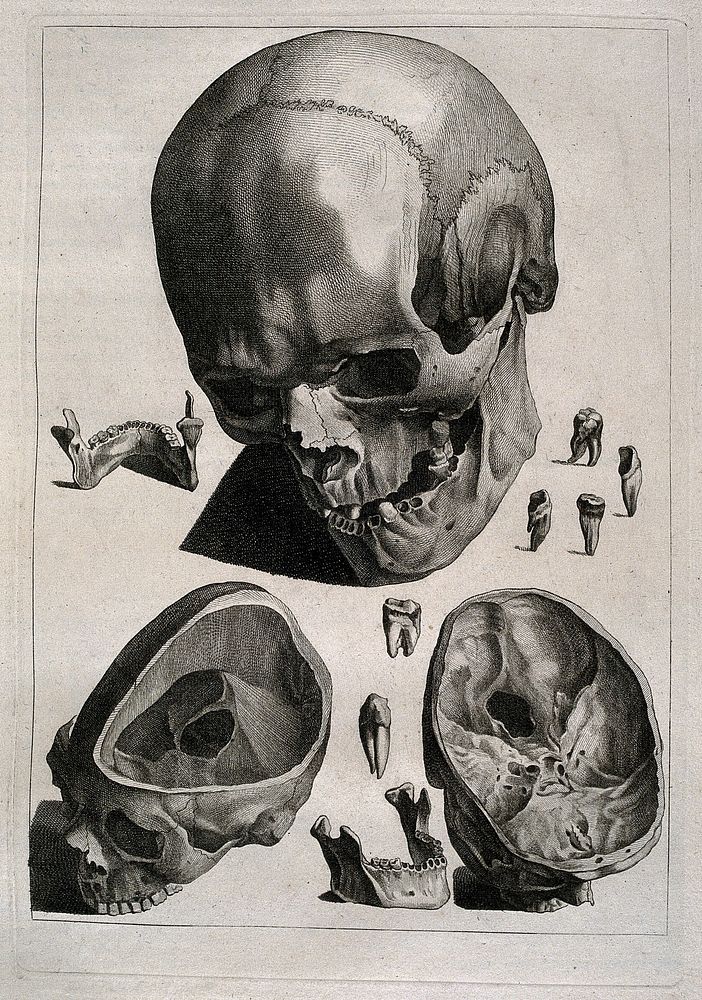 Human skull, with details showing the teeth and bones of the lower jaw and two sections through the skull. Etching by or…