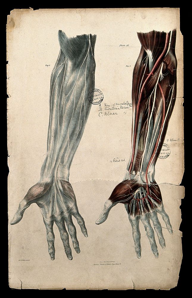 Nerves of the forearm and hand: anterior view. Coloured lithograph by William Fairland, 1839, after W. Bagg after W.J.E.…