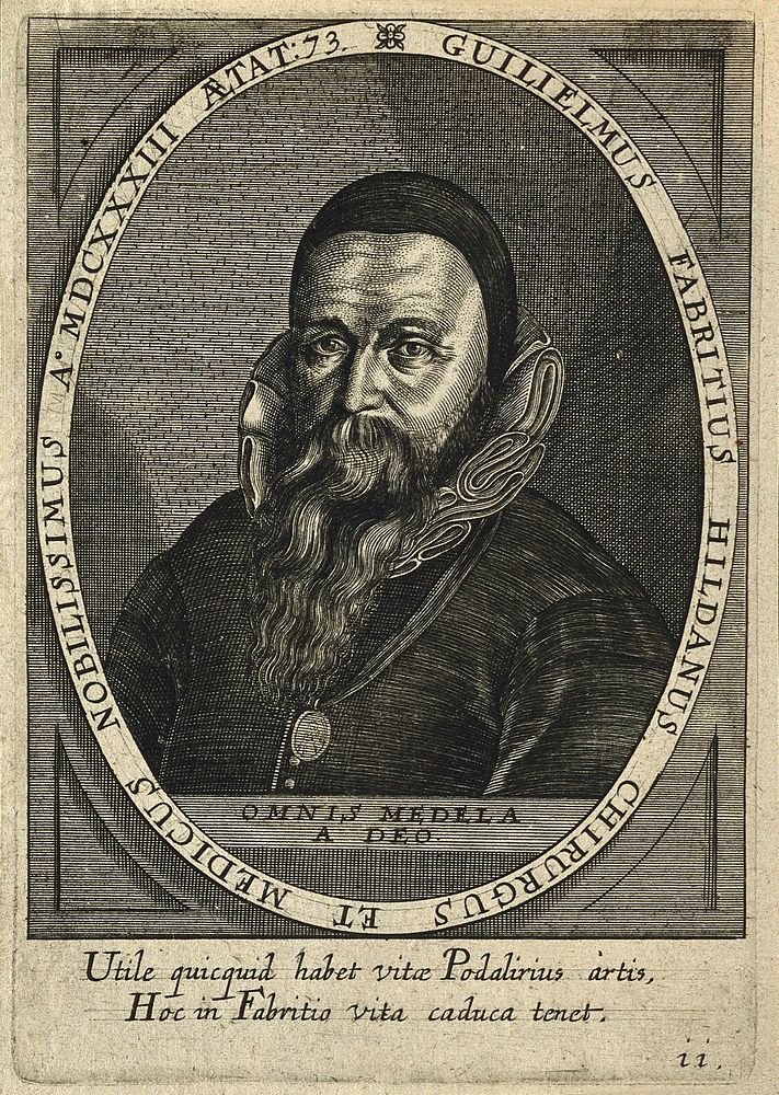 Guglielmus Fabricius (Wilhelm Fabry) of Hilden. Line engraving by C. Ammon, 1650.