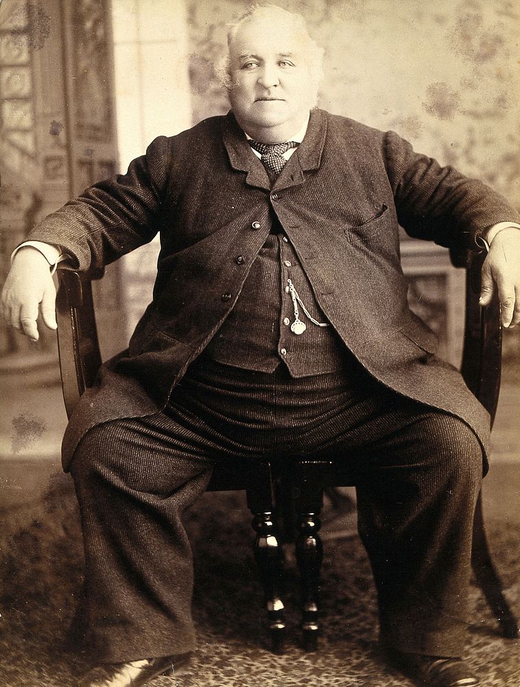 Thomas Dewhurst Jennings, seated on two dining chairs. Photograph, 1884.
