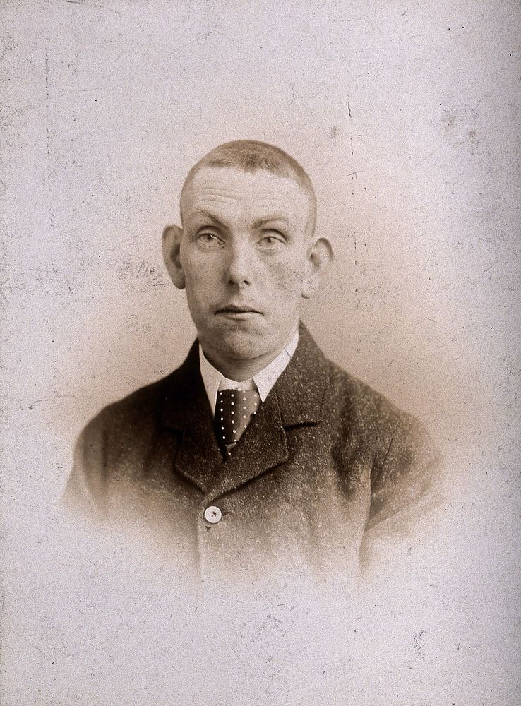 Head and shoulders of a young man with protruding ears. Photograph by Davis and Sons.
