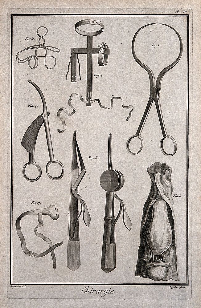 Surgery: an assortment of surgical instruments including tweezers known as "Helvetian tweezers" for cancer operations, and…