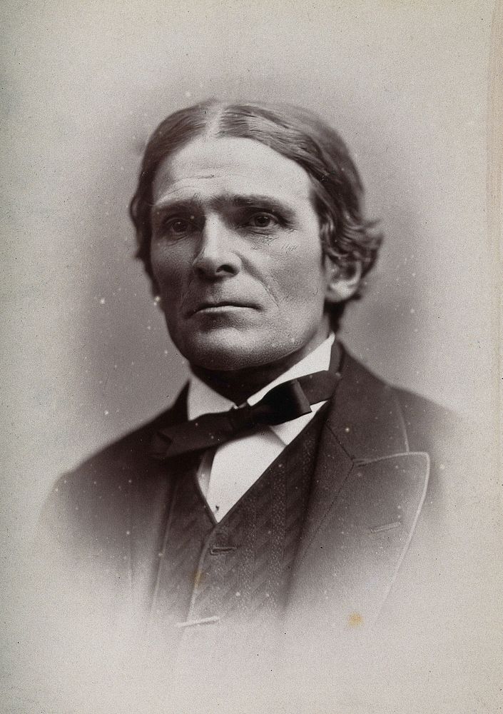 Sir John Scott Burdon-Sanderson. Photograph by G. Jerrard, 1881.