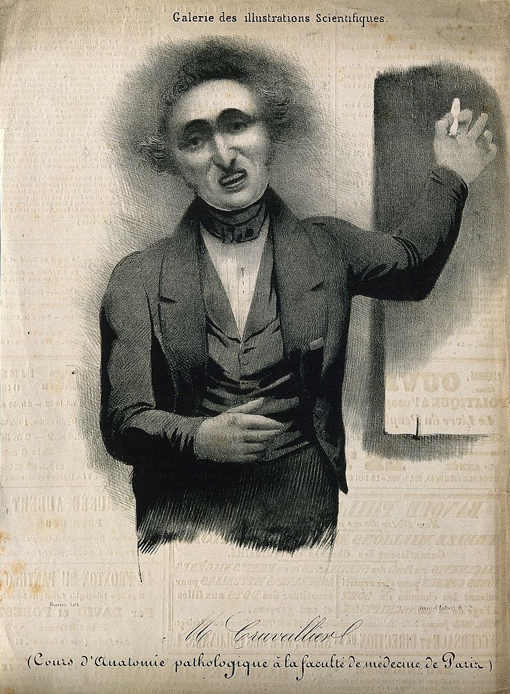 Jean Cruveilhier. Lithograph by C.J. Traviès.