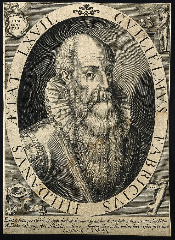 Guglielmus Fabricius of Hilden. Line engraving.