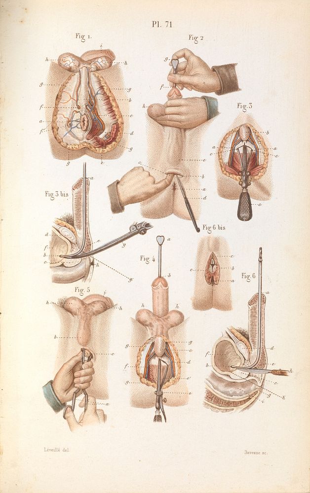 Plate 71, Surgical anatomy of the perineum and rectum.