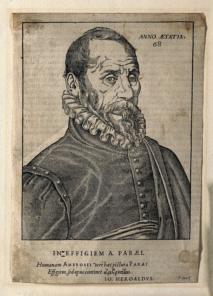 Ambroise Paré. Woodcut, 1582.