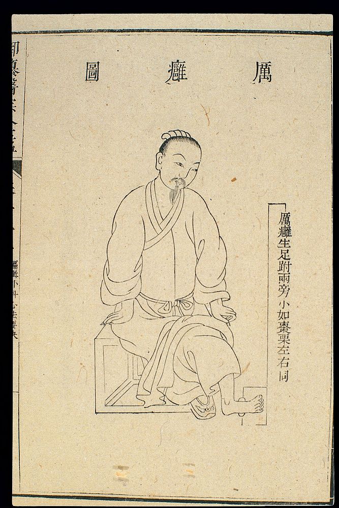Chinese C18 woodcut: External medicine - Friction ulcer