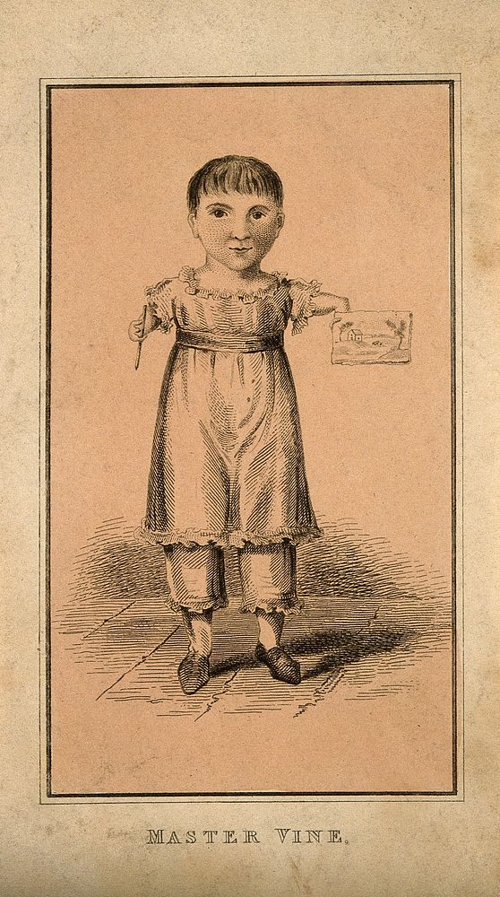 Master Vine, a child with deformed arms. Etching.