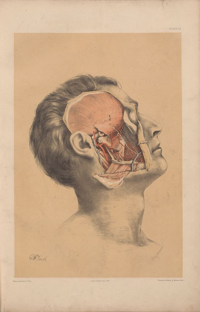 Plate XX. Superficial view of the pterygoid region.