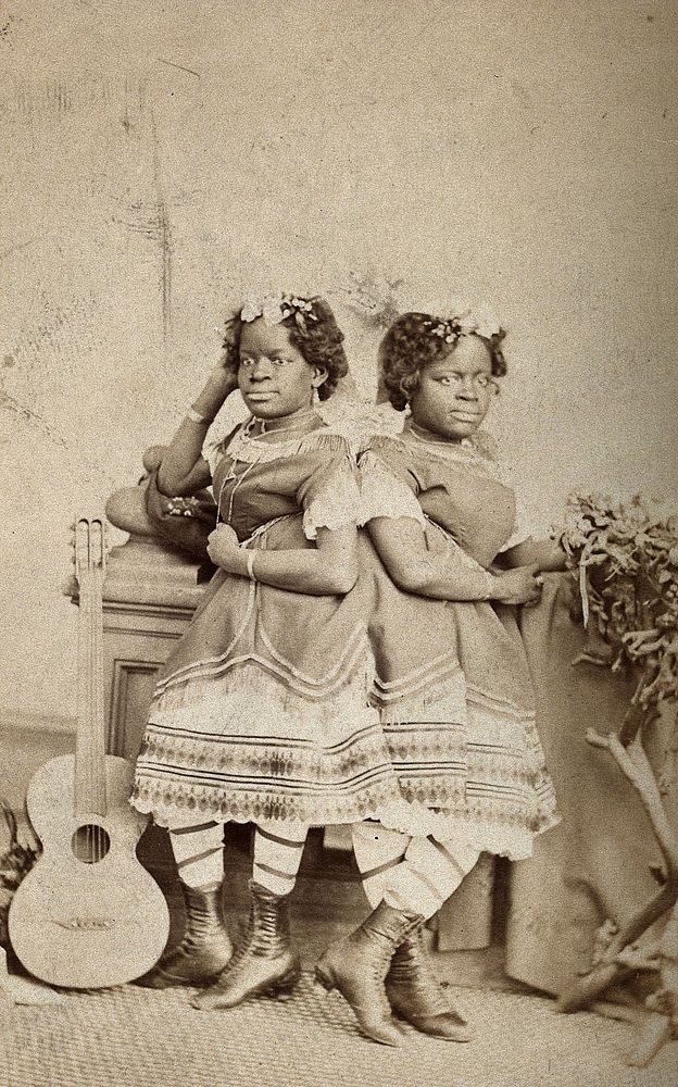 The Millie-Christine sisters, conjoined twins, standing. Photograph, c. 1871.