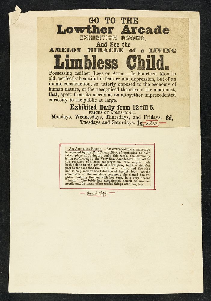 Undated handbill advertising 'The living wonder', M. Aish with a breast in place of her right leg, showing at London Dairy…