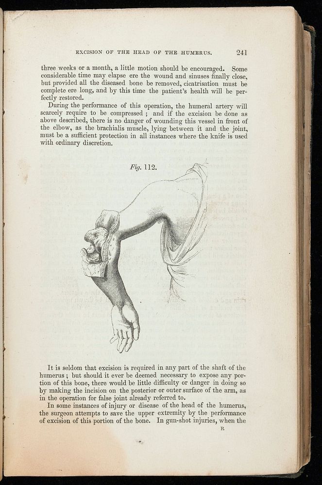 A system of practical surgery / By William Fergusson ; with illustrations by Bagg.