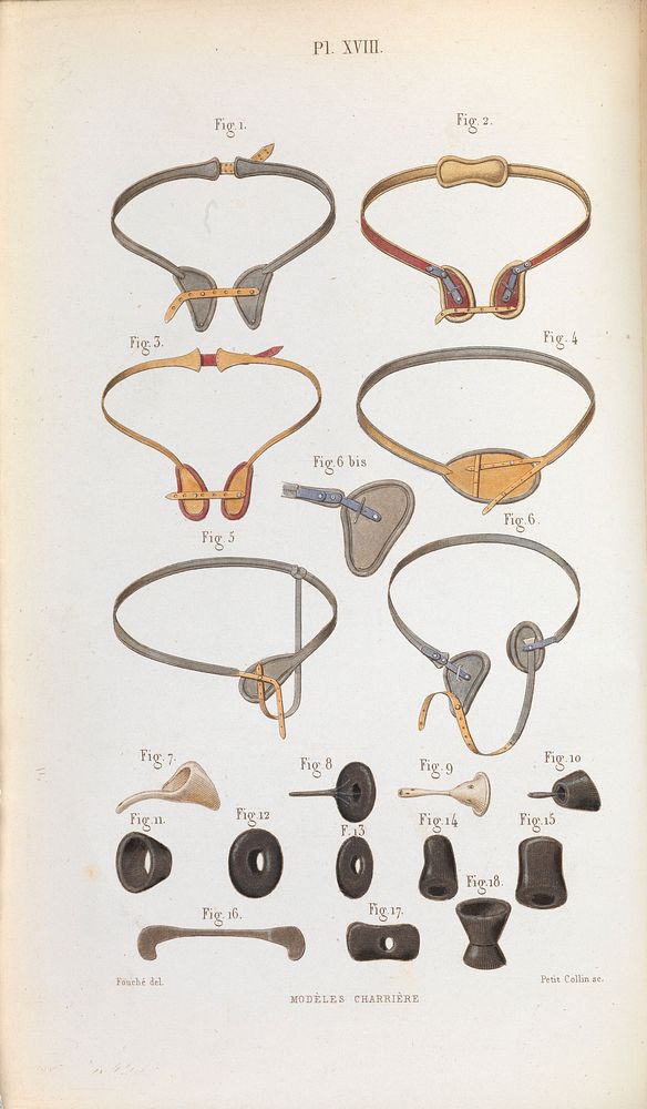 Plate XVIII, Various types of hernia trusses and pessaries.