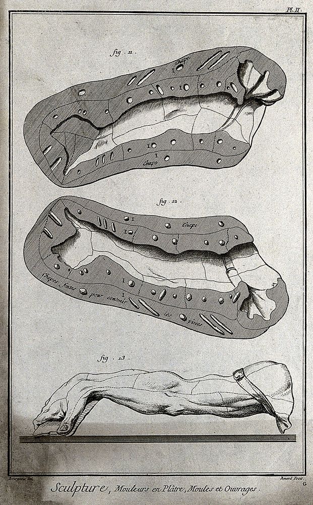 Two halves of a plaster mould of an arm and an entire plaster mould of an arm. Engraving by R. Bénard after Bourgeois.