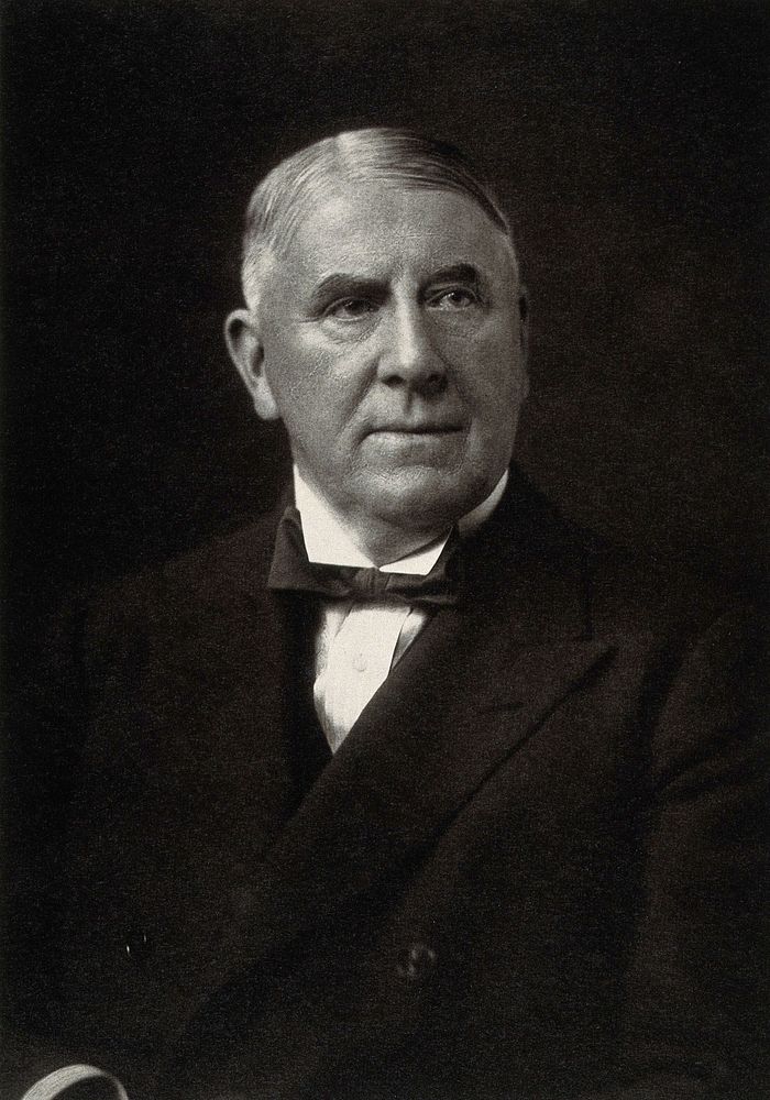 Berkeley George Andrew Moynihan, Baron Moynihan. Photograph.