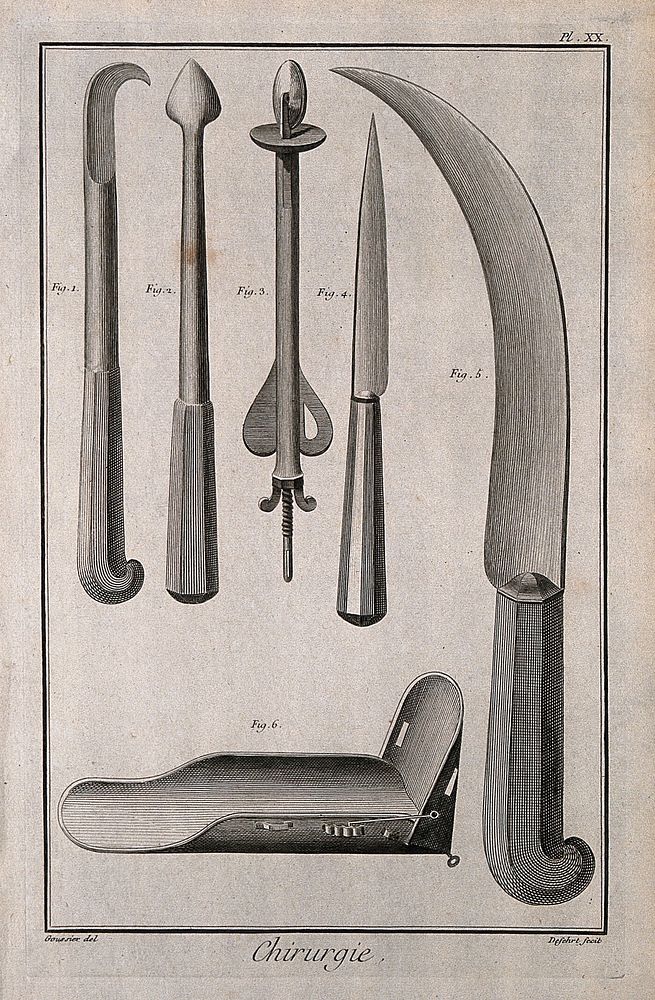 Surgery: surgical instruments, including instruments to extract the head of a dead foetus and knives. Engraving with etching…