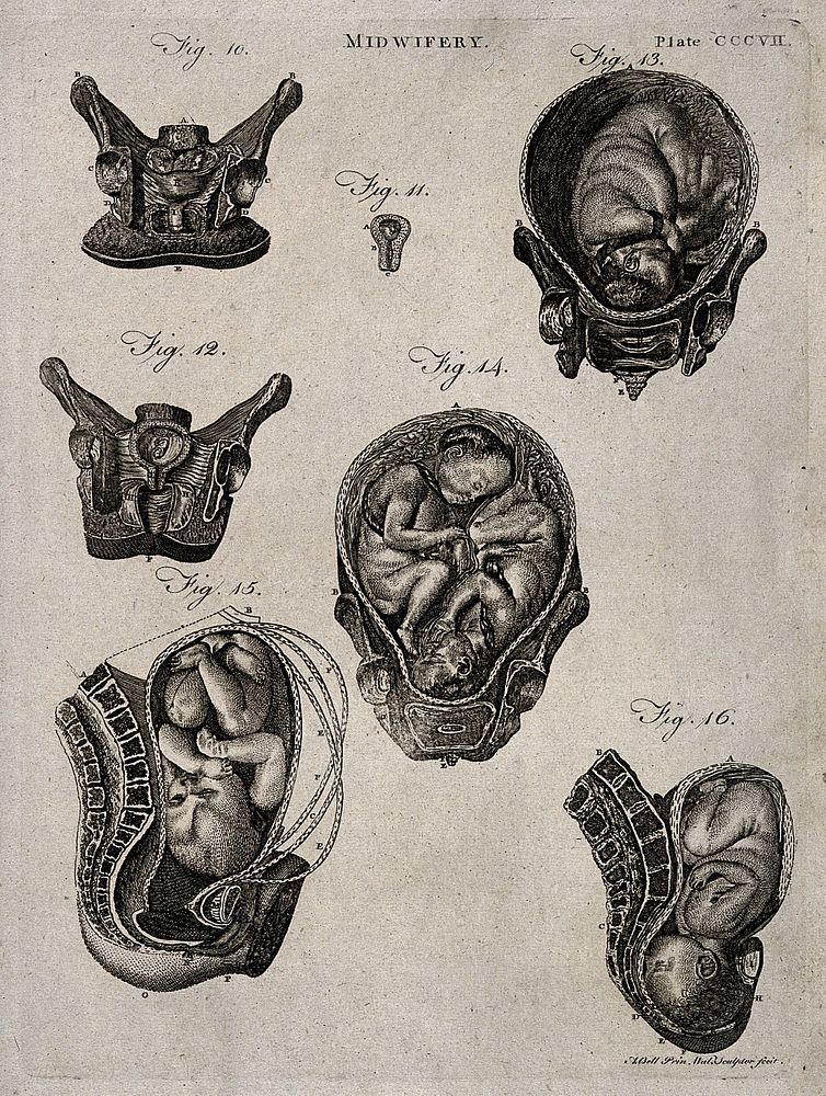 Cross-sections of seven different figures of the pregnant uterus. Engraving by A. Bell.