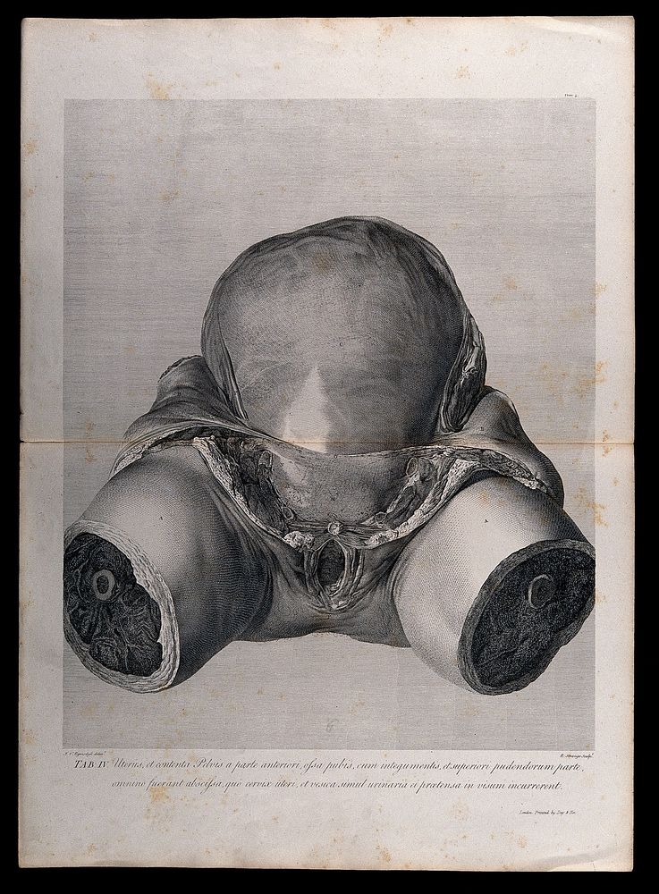 Front view of the pregnant uterus and pelvic area, showing the skin peeled away to reveal the swollen womb. Copperplate…