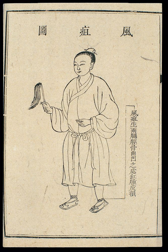 Chinese C18 woodcut: External medicine - 'wind ulcers'