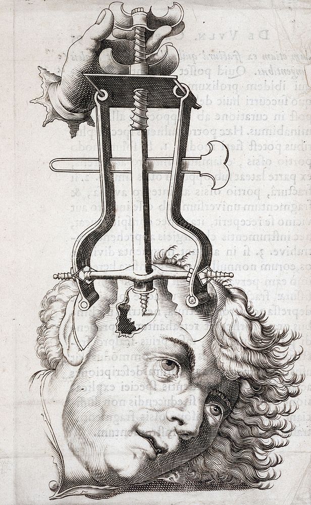 Succenturiatus anatomicus. Continens commentaria in Hippocratem, de capitis vulneribus. Additae in aliquot capita libri VIII…
