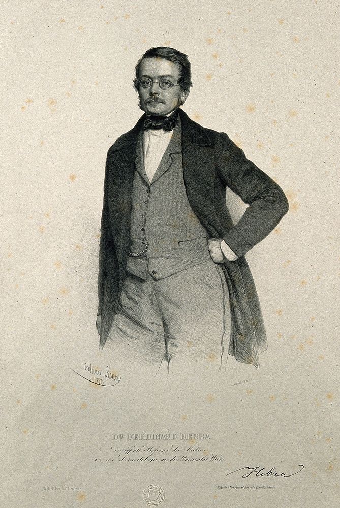 Ferdinand von Hebra. Lithograph by E. Kaiser, 1850.