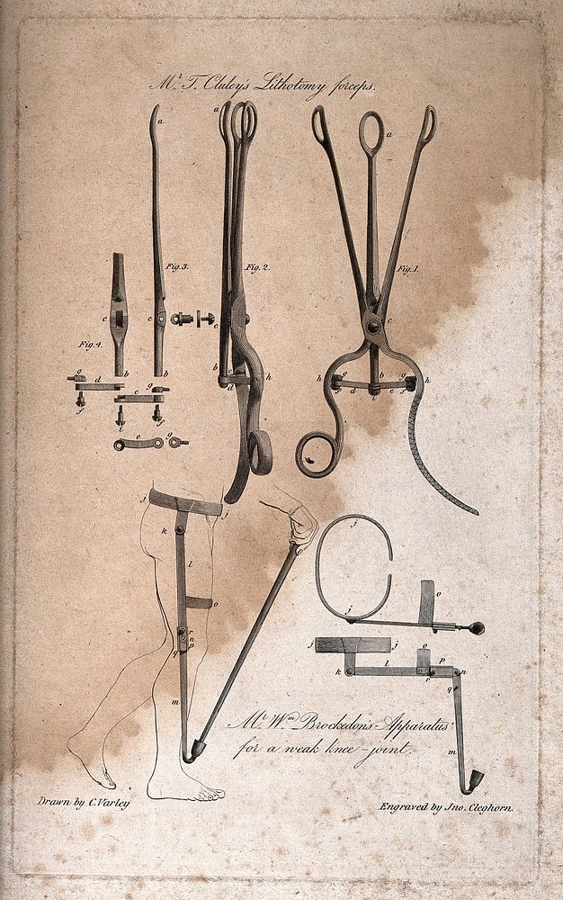 Surgical instruments, including lithotomy forceps and Mr. Brockedon's apparatus for weak knee joints. Engraving by J.…