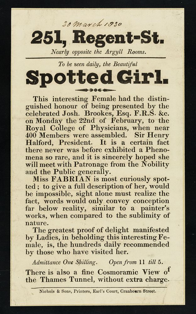 251, Regent-St. nearly opposite the Argyll Rooms : to be seen daily, the beautiful Spotted Girl ... Miss Fabian is most…