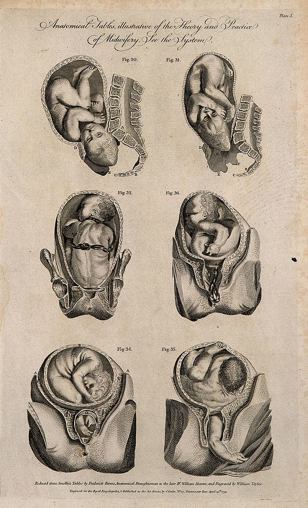Foetuses in utero: six figures showing cross-sections of foetuses in various positions in the uterus prior to and during…