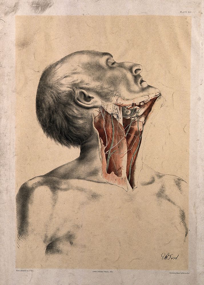 Dissection of the neck of a man, with the muscles, blood vessels and lymph nodes indicated. Colour lithograph by G.H. Ford…
