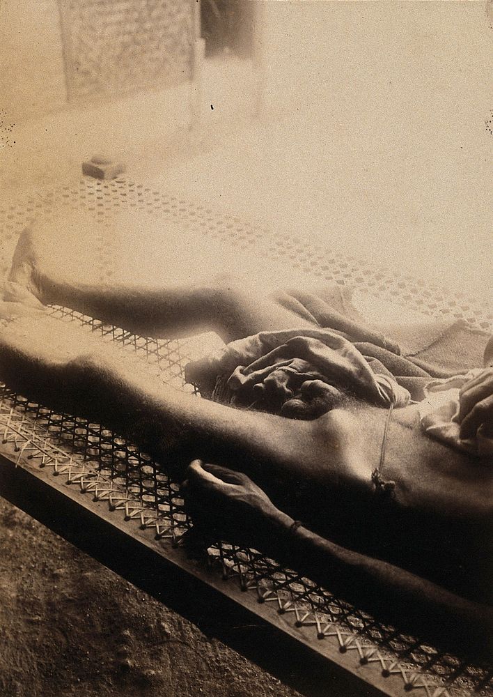 A man with plague lying on a rattan bed, Bombay.
