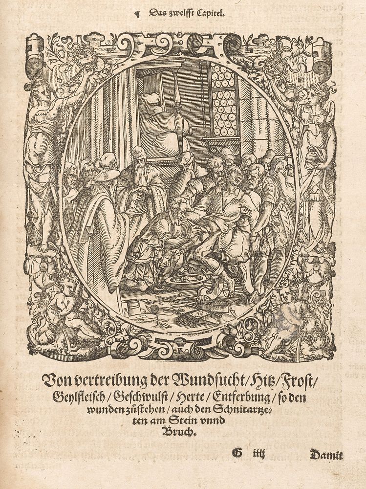 Opus chyrurgicum, des weitberumbten Hochgelehrten und Erfarnen / Aureoli Theophrasti Paracelsi ... Wund und Artzney Buch.…