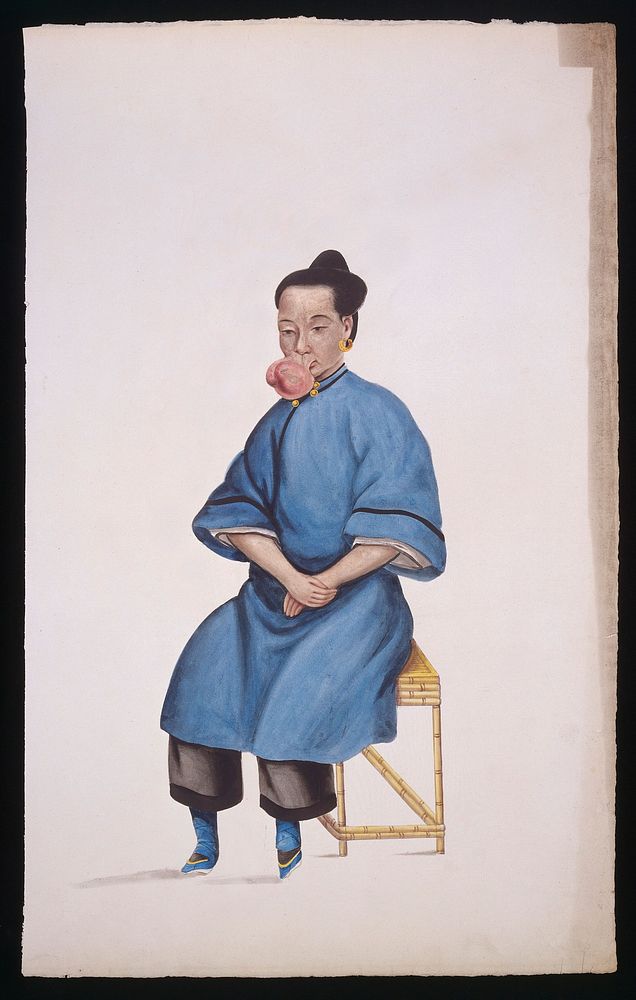 A woman (Kwo Pe) with a tumour hanging from her upper lip. Gouache, 18--, after Lam Qua, ca. 1839.