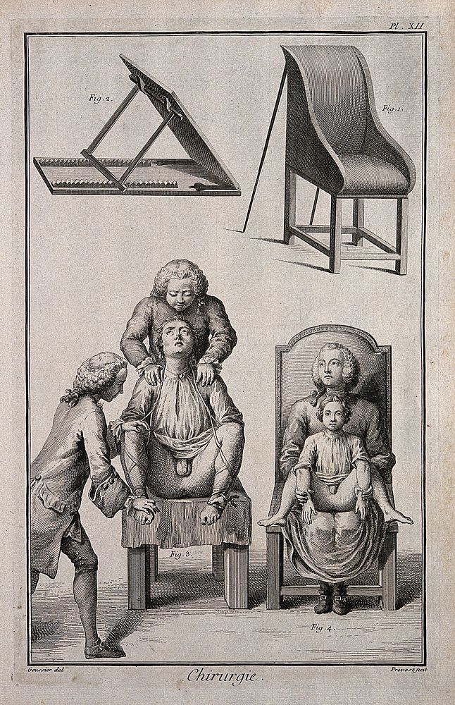 Surgery: above, a chair-bedstead and a patient-dossier; below, a man and a child seated on the chair-bedstead. Engraving by…
