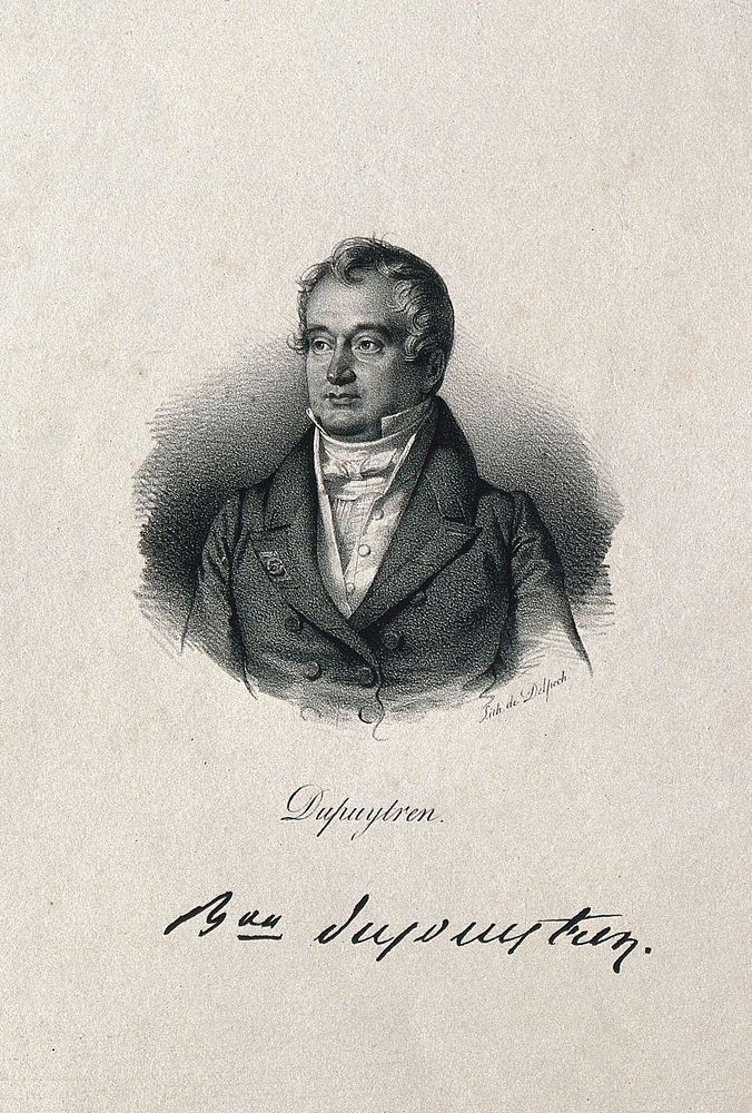 Guillaume, Baron Dupuytren. Lithograph.