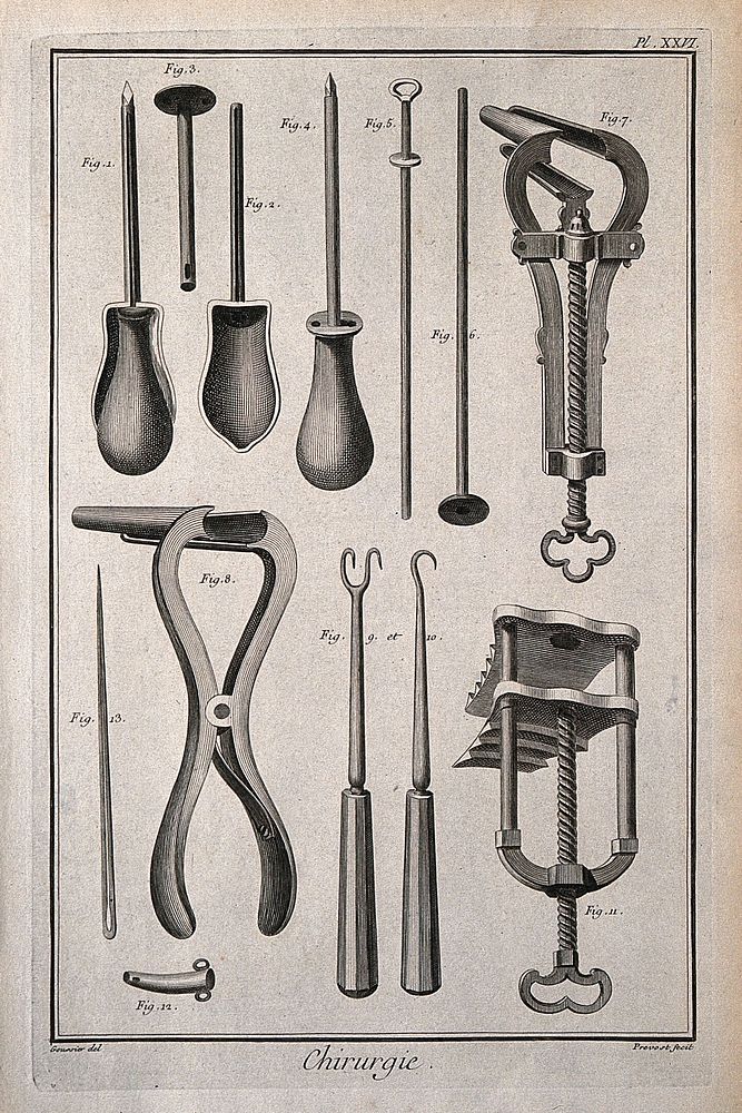 Surgery: surgical instruments, including a speculum for the uterus and a speculum for the anus. Engraving with etching by…