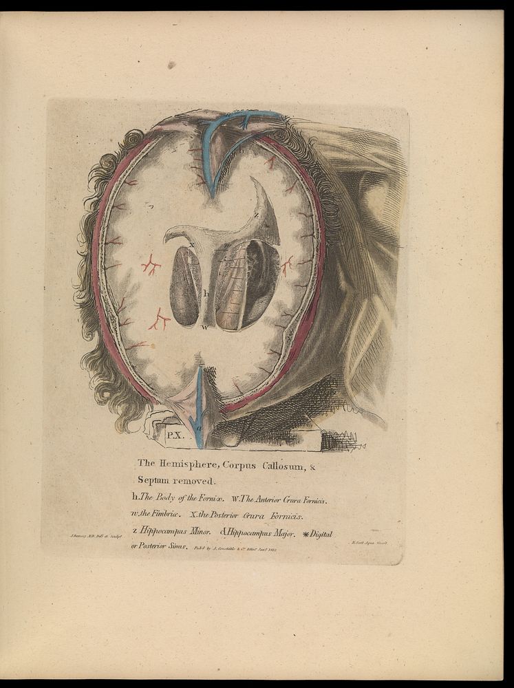 Anatomy of the heart, cranium, and brain : adapted to the purposes of the medical and surgical practitioner; to which is…