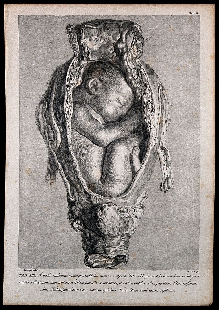 Dissection of a pregnant uterus, showing the foetus at nine months, with its head facing upwards. Copperplate engraving by…