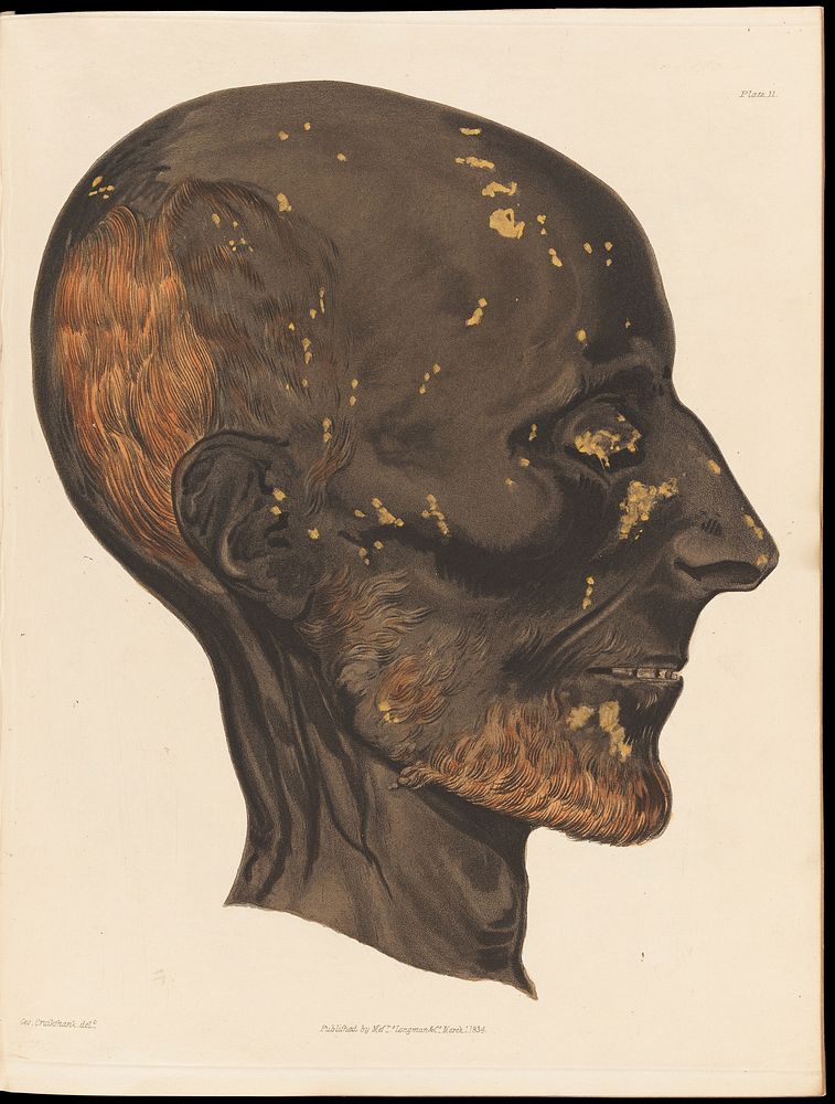 Profile view of a mummified male head