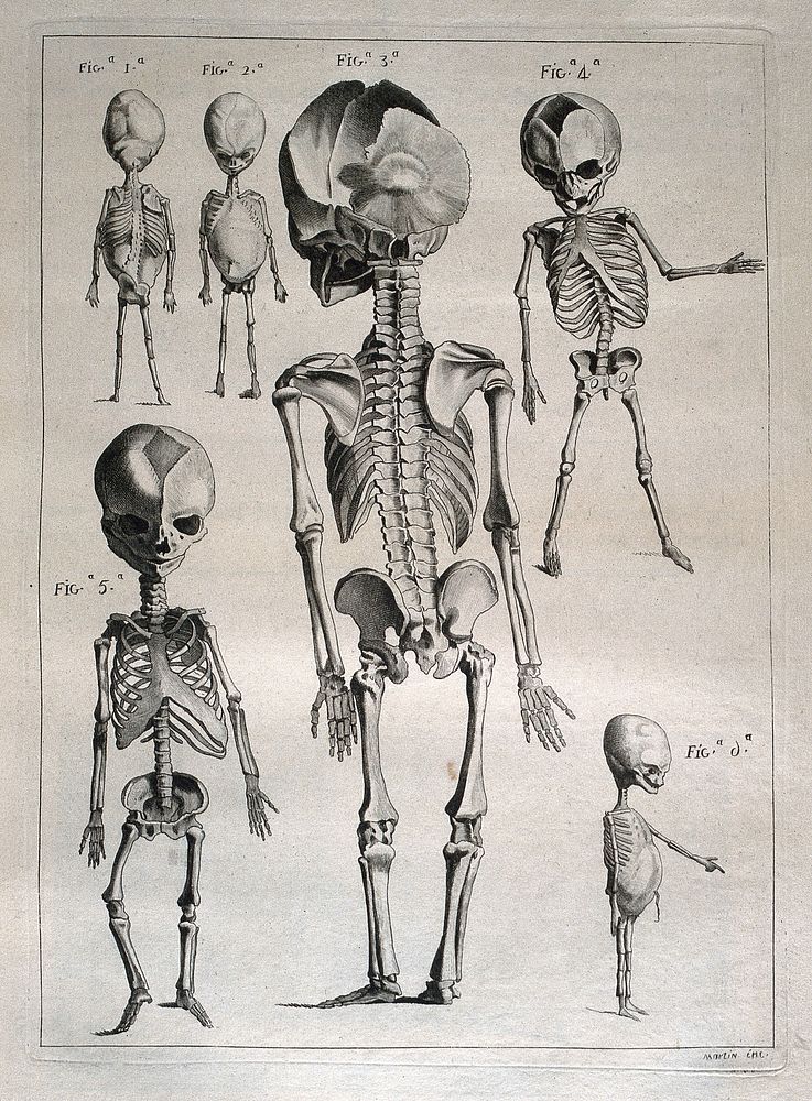 Foetal skeletons: six figures. Etching by Martin after J. Gamelin, 1778/1779.