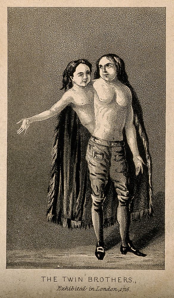 A man with two heads and two trunks, 1716. Aquatint.